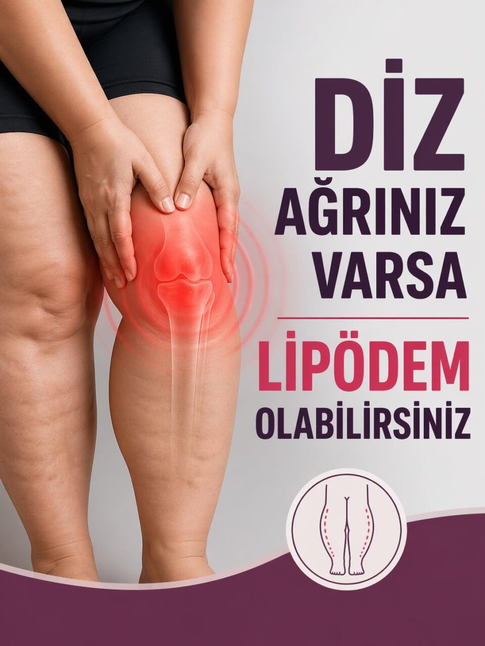 lipodem 095741977