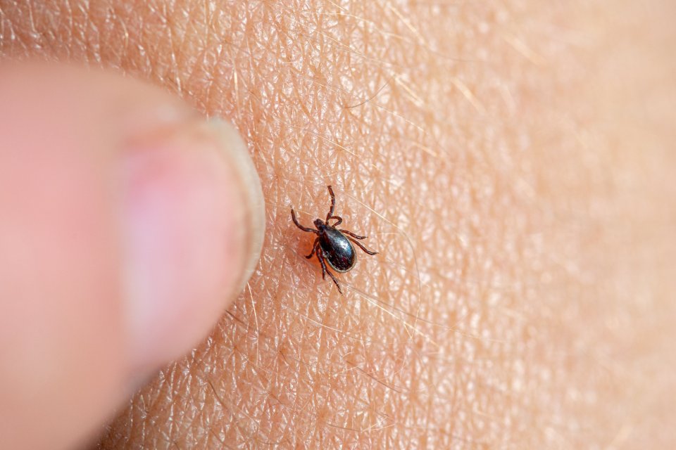 brown tick on a human skin 2025 02 19 19 32 57 utc min
